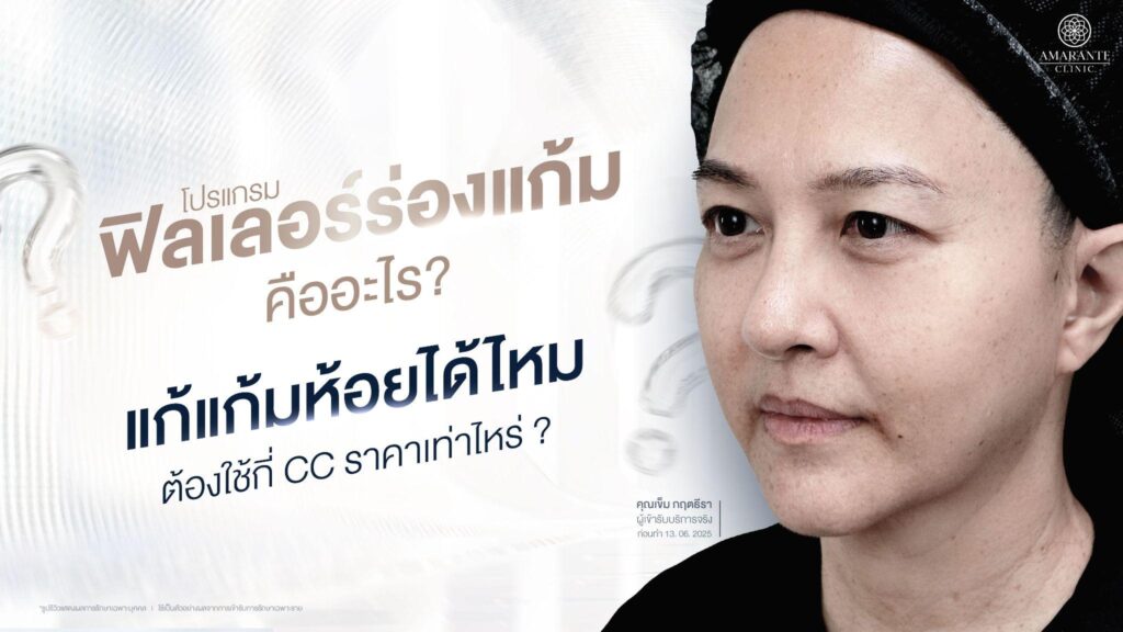 ฉีดฟิลเลอร์ร่องแก้ม คืออะไร? แก้แก้มห้อยได้ไหม