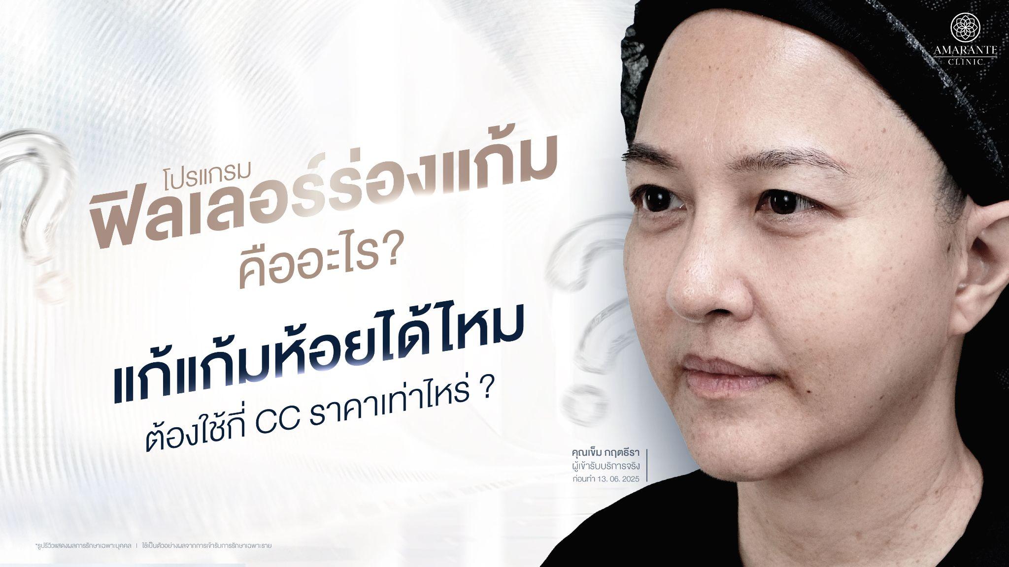 ฉีดฟิลเลอร์ร่องแก้ม คืออะไร? แก้แก้มห้อยได้ไหม