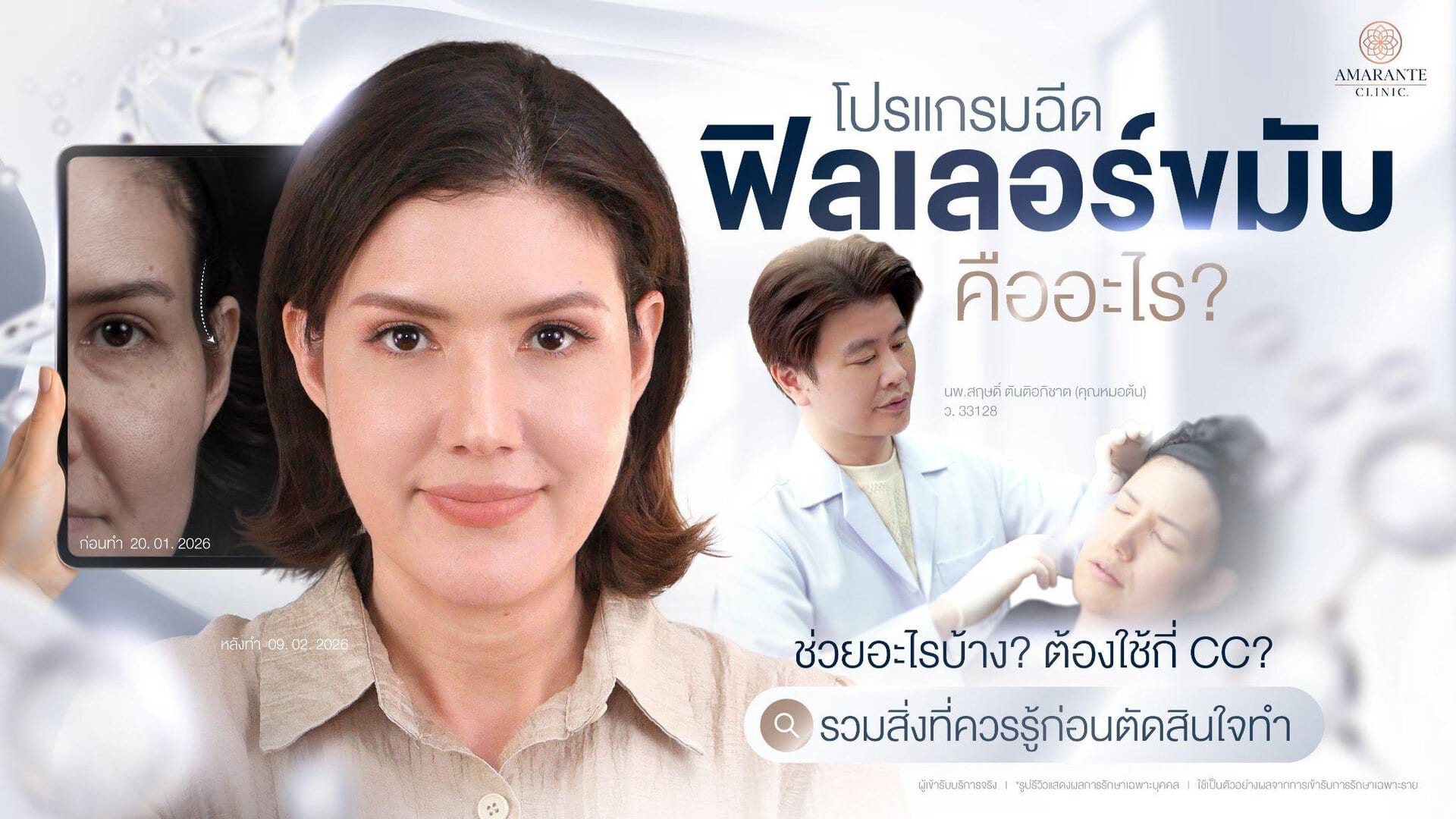 ฉีดฟิลเลอร์ขมับ คืออะไร? ช่วยอะไรบ้าง ต้องใช้กี่ CC ราคาเท่าไหร่