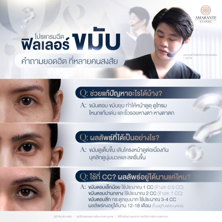 เรื่องที่ควรรู้เกี่ยวกับการฉีดฟิลเลอร์ขมับ