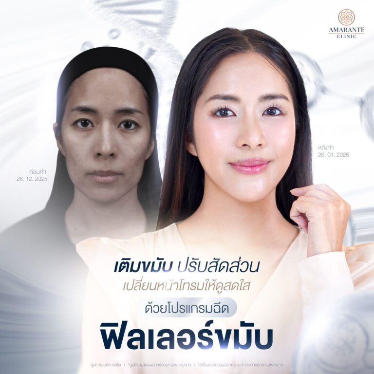 ฉีดฟิลเลอร์ขมับ ที่ Amarante Clinic